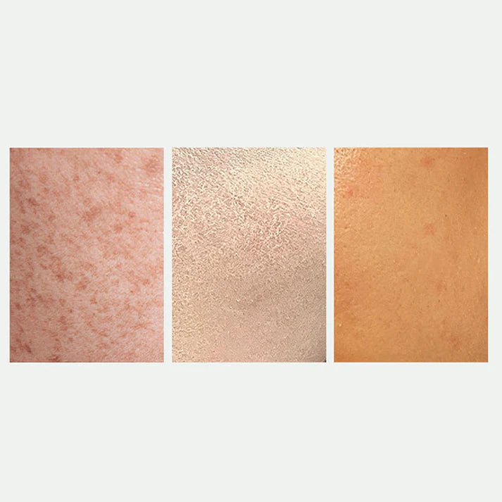 🎉hot sale🎉radiant skin & spot correcting spray|buy 1 get 1 free 💗